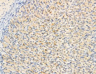 Anti-CCR2 antibody used in IHC (Paraffin sections) (IHC-P). GTX04115