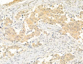 Anti-CCR2 antibody used in IHC (Paraffin sections) (IHC-P). GTX04115