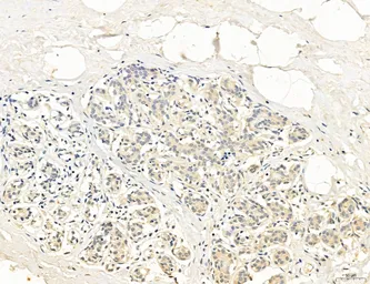 Anti-CCR2 antibody used in IHC (Paraffin sections) (IHC-P). GTX04115