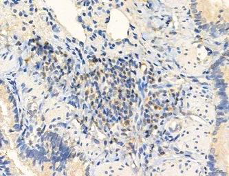 Anti-CCR2 antibody used in IHC (Paraffin sections) (IHC-P). GTX04115