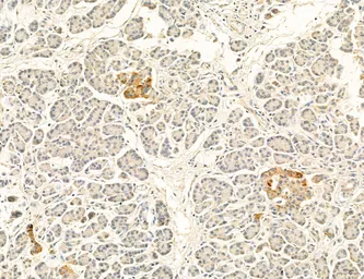 Anti-CCR2 antibody used in IHC (Paraffin sections) (IHC-P). GTX04115