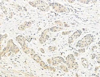 Anti-CCR2 antibody used in IHC (Paraffin sections) (IHC-P). GTX04115