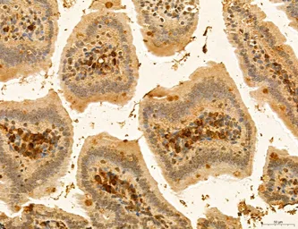 Anti-CCR2 antibody used in IHC (Paraffin sections) (IHC-P). GTX04115