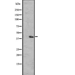 Anti-CCR2 antibody used in Western Blot (WB). GTX04115