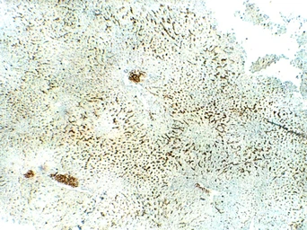 Anti-SLC31A1 / CTR1 antibody used in IHC (Paraffin sections) (IHC-P). GTX04251