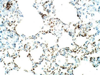 Anti-SLC31A1 / CTR1 antibody used in IHC (Paraffin sections) (IHC-P). GTX04251