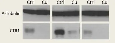 Anti-SLC31A1 / CTR1 antibody used in Western Blot (WB). GTX04251