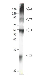 Anti-SLC31A1 / CTR1 antibody used in Western Blot (WB). GTX04251