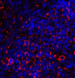 Anti-CD80 antibody used in IHC (Paraffin sections) (IHC-P). GTX04260