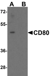 Anti-CD80 antibody used in Western Blot (WB). GTX04260