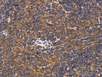 Anti-TRP2 antibody used in IHC (Paraffin sections) (IHC-P). GTX04261