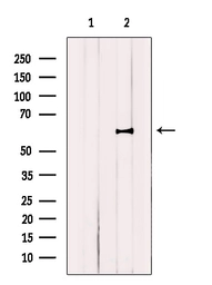 Anti-TRP2 antibody used in Western Blot (WB). GTX04261