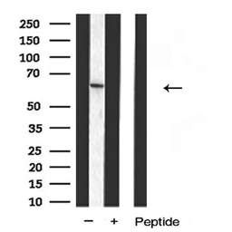 Anti-TRP2 antibody used in Western Blot (WB). GTX04261