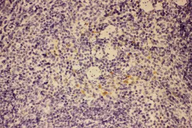 Anti-GM-CSF antibody used in IHC (Paraffin sections) (IHC-P). GTX04337