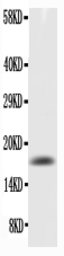 Anti-GM-CSF antibody used in Western Blot (WB). GTX04337