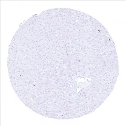 Anti-Ki67 antibody [MSVA-267M] HistoMAX&trade; used in IHC (Paraffin sections) (IHC-P). GTX04361