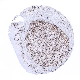 Anti-Ki67 antibody [MSVA-267M] HistoMAX&trade; used in IHC (Paraffin sections) (IHC-P). GTX04361