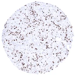 Anti-Ki67 antibody [MSVA-267M] HistoMAX&trade; used in IHC (Paraffin sections) (IHC-P). GTX04361