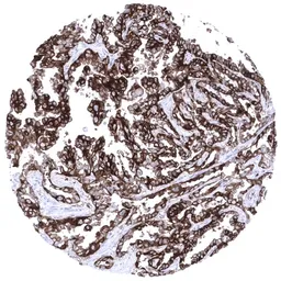 Anti-CD7 antibody [MSVA-007R] HistoMAX&trade; used in IHC (Paraffin sections) (IHC-P). GTX04390