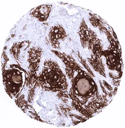 Anti-Cytokeratin 10 antibody [MSVA-610M] HistoMAX&trade; used in IHC (Paraffin sections) (IHC-P). GTX04401