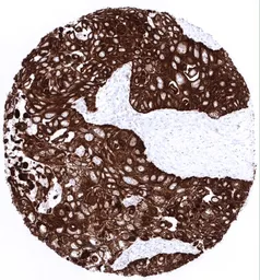 Anti-Cytokeratin 5 antibody [MSVA-605M] HistoMAX&trade; used in IHC (Paraffin sections) (IHC-P). GTX04402