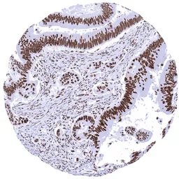 Anti-MSH2 antibody [MSVA-902M] HistoMAX&trade; used in IHC (Paraffin sections) (IHC-P). GTX04408