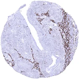 Anti-MSH2 antibody [MSVA-902M] HistoMAX&trade; used in IHC (Paraffin sections) (IHC-P). GTX04408