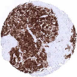 Anti-Arginase 1 antibody [MSVA-511R] HistoMAX&trade; used in IHC (Paraffin sections) (IHC-P). GTX04426