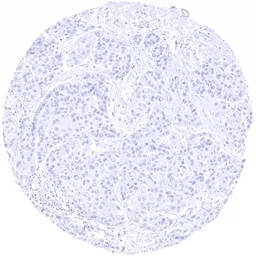 Anti-Arginase 1 antibody [MSVA-511R] HistoMAX&trade; used in IHC (Paraffin sections) (IHC-P). GTX04426