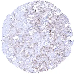 Anti-Her2 / ErbB2 antibody [MSVA-340R] HistoMAX&trade; used in IHC (Paraffin sections) (IHC-P). GTX04428