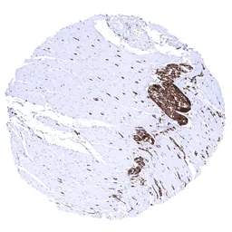 Anti-PGP9.5 antibody [MSVA-905R] HistoMAX&trade; used in IHC (Paraffin sections) (IHC-P). GTX04438