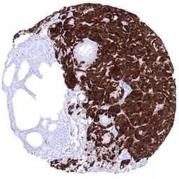 Anti-PGP9.5 antibody [MSVA-905R] HistoMAX&trade; used in IHC (Paraffin sections) (IHC-P). GTX04438