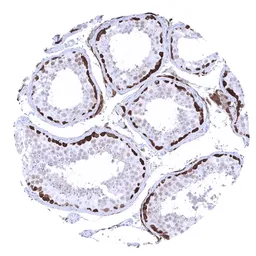 Anti-PGP9.5 antibody [MSVA-905R] HistoMAX&trade; used in IHC (Paraffin sections) (IHC-P). GTX04438