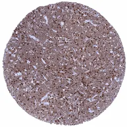 Anti-ZAP70 antibody [MSVA-870R] HistoMAX&trade; used in IHC (Paraffin sections) (IHC-P). GTX04441