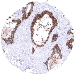 Anti-Thrombomodulin antibody [MSVA-141M] HistoMAX&trade; used in IHC (Paraffin sections) (IHC-P). GTX04446