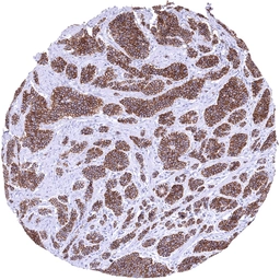 Anti-Thrombomodulin antibody [MSVA-141M] HistoMAX&trade; used in IHC (Paraffin sections) (IHC-P). GTX04446