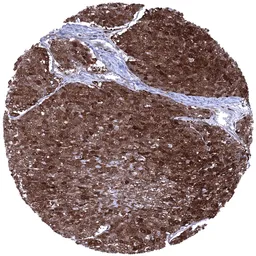 Anti-Cystatin A antibody [MSVA-461M] HistoMAX&trade; used in IHC (Paraffin sections) (IHC-P). GTX04453