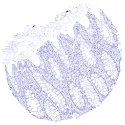 Anti-Cystatin A antibody [MSVA-461M] HistoMAX&trade; used in IHC (Paraffin sections) (IHC-P). GTX04453