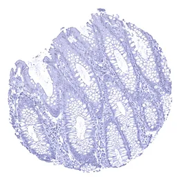 Anti-Calbindin antibody [MSVA-471M] HistoMAX&trade; used in IHC (Paraffin sections) (IHC-P). GTX04454