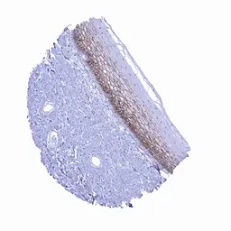 Anti-Occludin antibody [MSVA-415M] HistoMAX&trade; used in IHC (Paraffin sections) (IHC-P). GTX04461