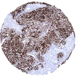 Anti-UPK1A antibody [MSVA-735M] HistoMAX&trade; used in IHC (Paraffin sections) (IHC-P). GTX04462