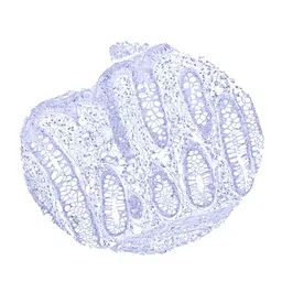 Anti-UPK1A antibody [MSVA-735M] HistoMAX&trade; used in IHC (Paraffin sections) (IHC-P). GTX04462