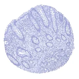 Anti-Kallikrein 7 antibody [MSVA-707M] HistoMAX&trade; used in IHC (Paraffin sections) (IHC-P). GTX04475