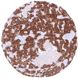 Anti-GAD65 antibody [MSVA-602M] HistoMAX&trade; used in IHC (Paraffin sections) (IHC-P). GTX04477