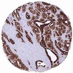 Anti-PSA antibody [MSVA-603R] HistoMAX&trade; used in IHC (Paraffin sections) (IHC-P). GTX04481