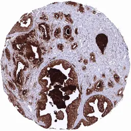 Anti-PSA antibody [MSVA-603R] HistoMAX&trade; used in IHC (Paraffin sections) (IHC-P). GTX04481