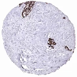 Anti-p53 antibody [MSVA-053R] HistoMAX&trade; used in IHC (Paraffin sections) (IHC-P). GTX04482