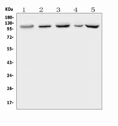 Anti-Polycystin 2 antibody used in Western Blot (WB). GTX04499