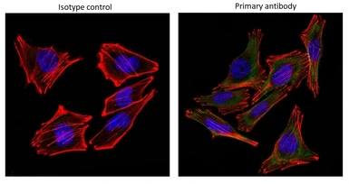 Anti-S100 beta antibody [4C4.9] used in Immunocytochemistry/ Immunofluorescence (ICC/IF). GTX04511