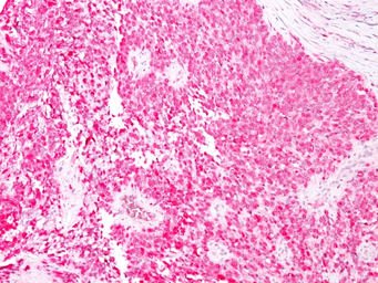 Anti-S100 beta antibody [4C4.9] used in IHC (Paraffin sections) (IHC-P). GTX04511